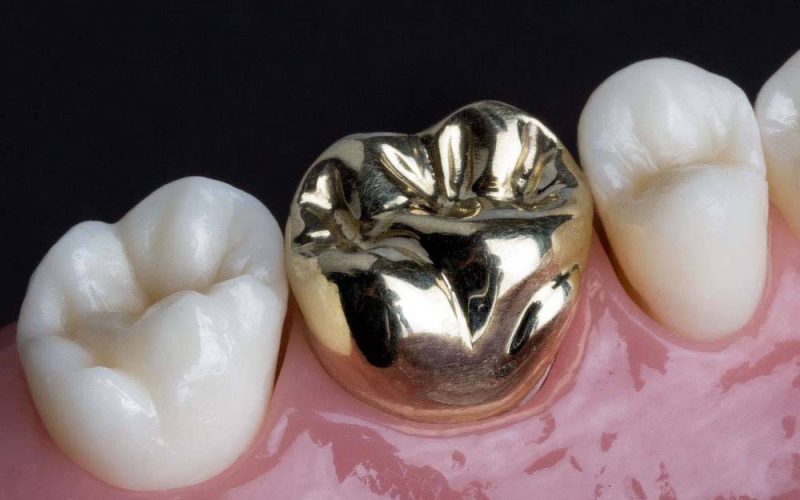 crown2